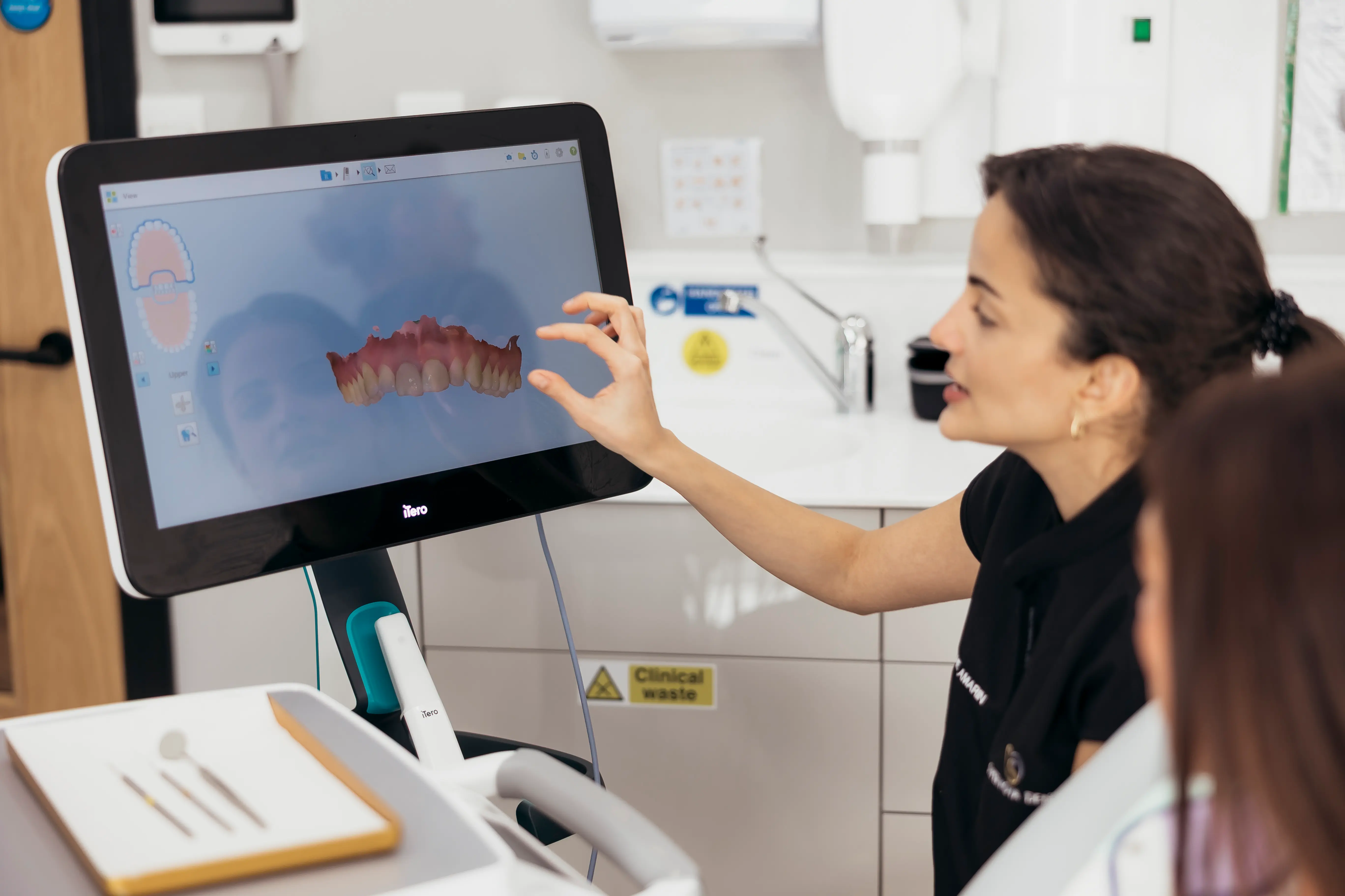 Root canal tooth restoration