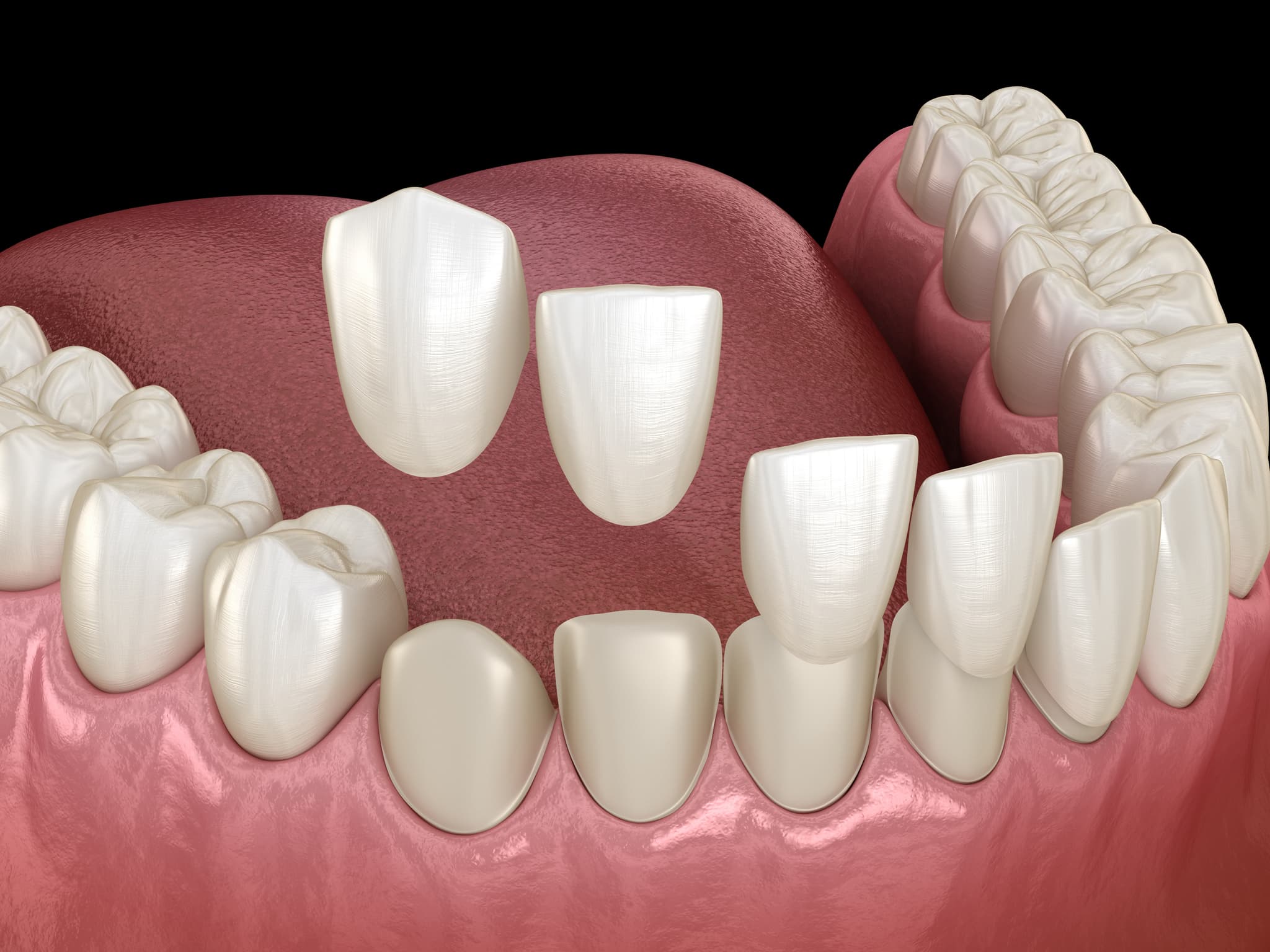 Private Dentist in Bridgwater, Somerset | Supernova Dental