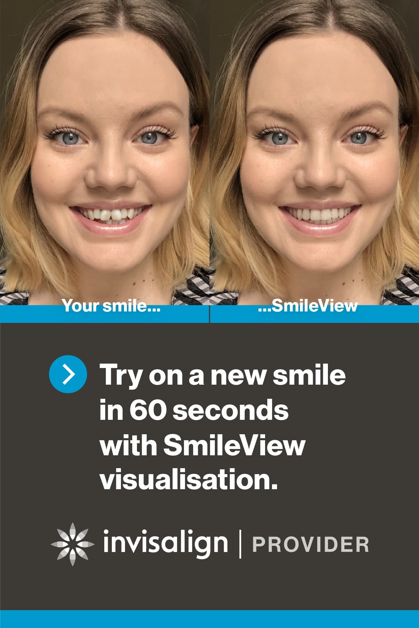 Invisalign Smile View