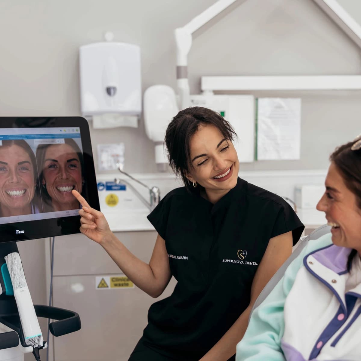 Composite bonding treatment and final smile results